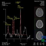 Neuromed 11 1.34806373512E19 1348067221799636789