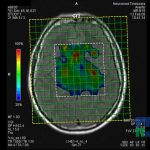 Neuromed 11 1.34806373512E19 13480672311972109742