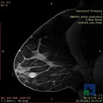 Neuromed 11 1.34864304513E19 13486430681696748757