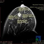 Neuromed 11 1.34864306817E19 13486430771217577999