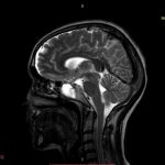 Neuromed 11 247