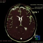 Neuromed 11 259