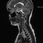 Neuromed 11 329