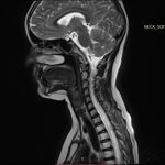 Neuromed 11 331