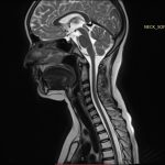 Neuromed 11 333