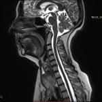 Neuromed 11 337