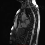 Neuromed 11 379