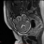 Neuromed 11 449