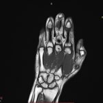 Neuromed 11 471