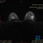 Neuromed 11 527