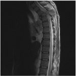 Neuromed 11 589