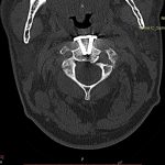 Neuromed-12-1.34805391821E+19-13480578121309588232