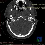 Neuromed-12-183