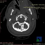 Neuromed-12-187