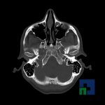 Neuromed-12-193
