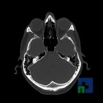 Neuromed-12-197