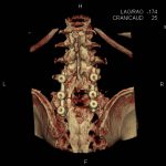 Neuromed-12-287