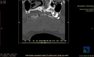 Neuromed-12-595