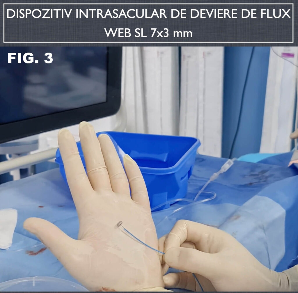 FIG 3