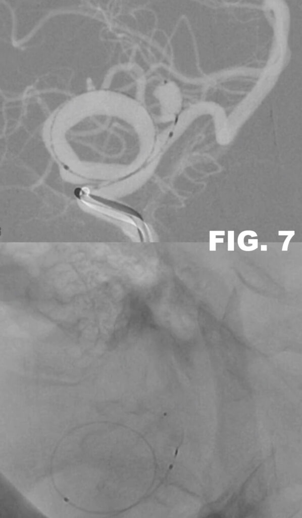 FIG 7 2